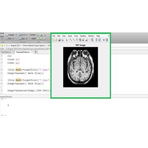 Nature Inspired Algorithm for Image Fusion using Advance Variant of Wavelet Transform and Firefly Optimization