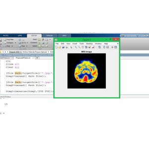 Nature Inspired Algorithm for Image Fusion using Advance Variant of Wavelet Transform and Firefly Optimization