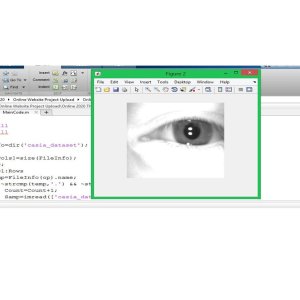 AI Iris Gender Recognition: LBP-LDA Feature Extraction Approach