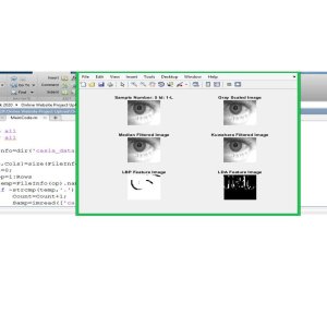 AI Iris Gender Recognition: LBP-LDA Feature Extraction Approach
