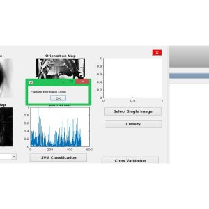 Driver Drowsiness Detection using SVM-FA and Cascade Classifiers