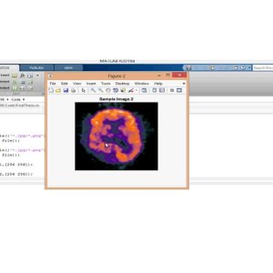 Hybrid GWO-ST Image Fusion using SWT Feature Extraction
