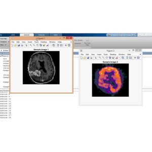 Hybrid GWO-ST Image Fusion using SWT Feature Extraction