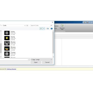"Image Fusion using HT-PCA for PET and MRI Fusion"