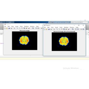 "Image Fusion using HT-PCA for PET and MRI Fusion"