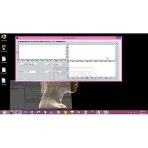 Medical Image Enhancement: Speckle Noise Removal Filters