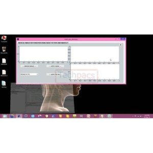 Medical Image Enhancement: Speckle Noise Removal Filters