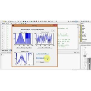 "ECG Signal Noise Reduction Using Adaptive Filtration for Efficient Signal Enhancement"