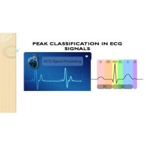 Detecting Diseases Using ECG Peak Classification Approach