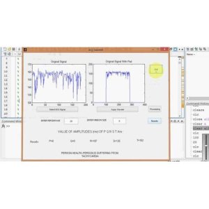 Detecting Diseases Using ECG Peak Classification Approach