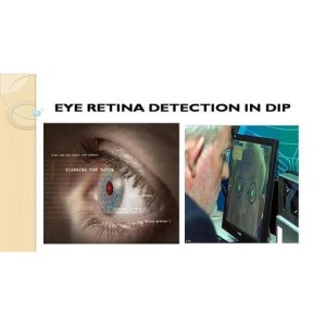 Real Time Eye Retina Detection Using Digital Image Processing