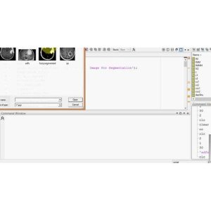 Fuzzy c-means clustering for image segmentation in MATLAB.
