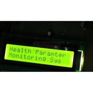 Microcontroller-Based Pulse Rate Monitoring and SMS Remote Alerting System Using GSM