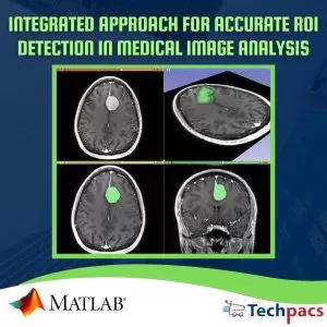 Integrated Fuzzy System and PSO Algorithm for Accurate ROI Detection and Data Security in Medical Image Analysis